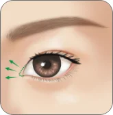 Illustration of the inner corner fold being released